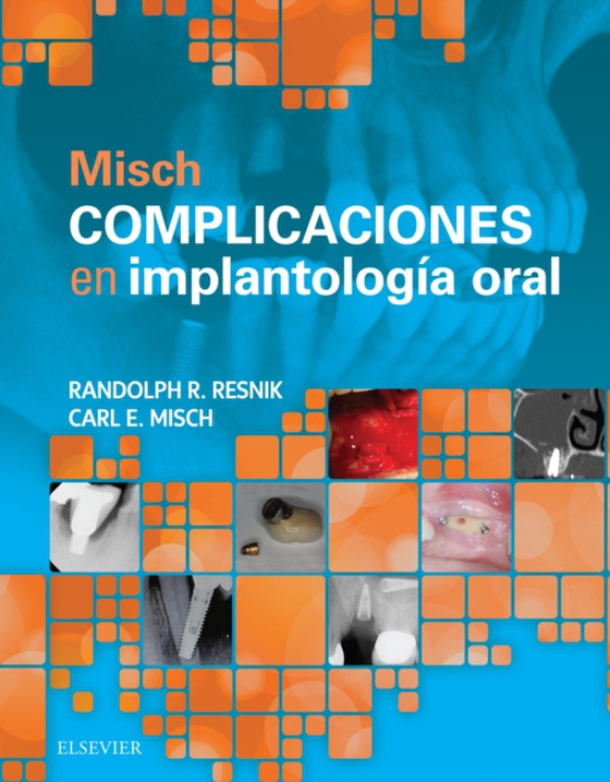 Misch. Complicaciones en implantología oral (e-bog) af Misch, Carl E.