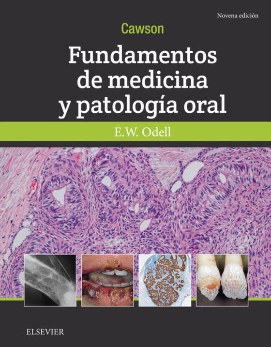 Cawson.Fundamentos de medicina y patología oral (e-bog) af Cawson, Roderick A.