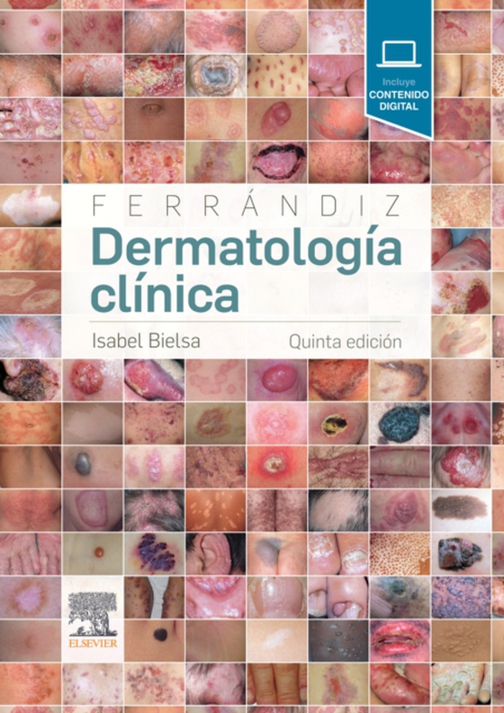 Ferrándiz. Dermatología clínica (e-bog) af -