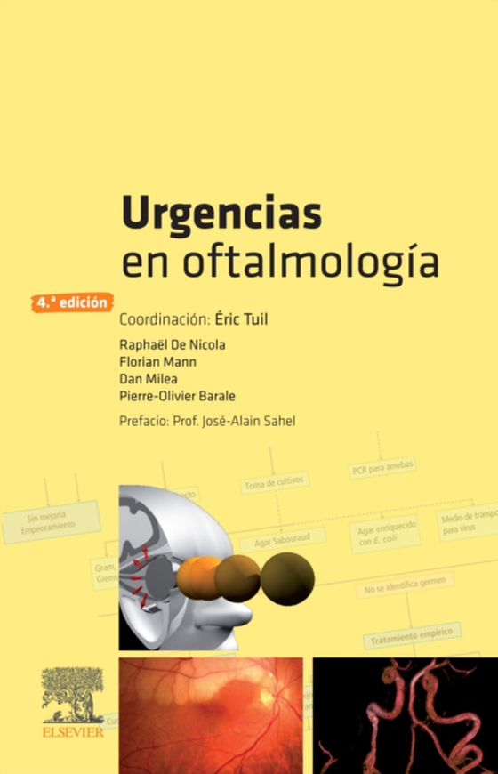 Urgencias en oftalmología (e-bog) af Barale, Pierre-Olivier