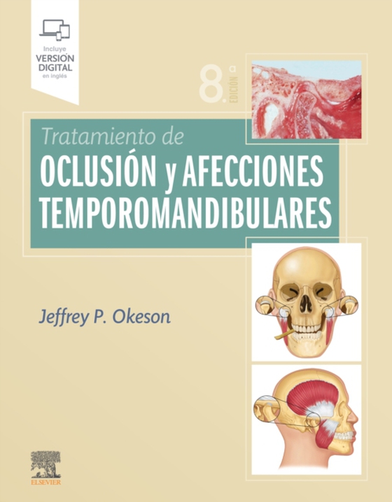 Tratamiento de oclusión y afecciones temporomandibulares (e-bog) af Okeson, Jeffrey P.