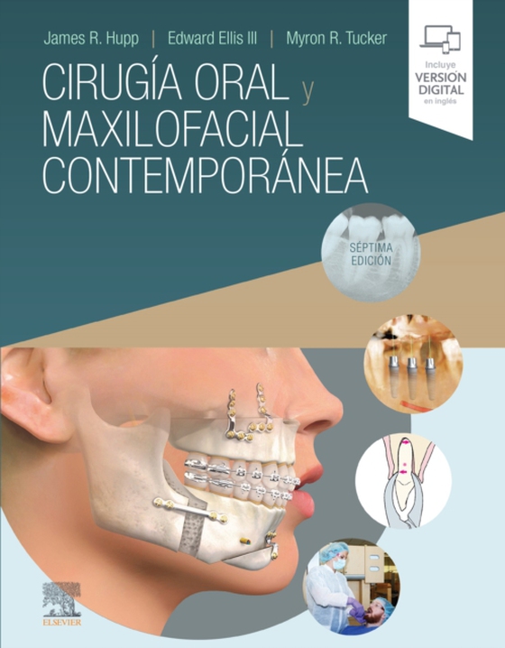 Cirugía oral y maxilofacial contemporánea (e-bog) af Tucker, Myron R.