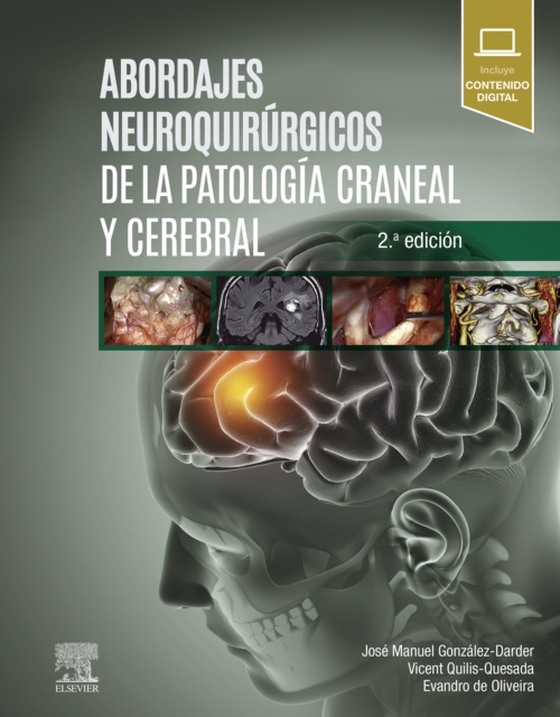 Abordajes neuroquirúrgicos de la patología craneal y cerebral (e-bog) af Oliveira, Evandro de