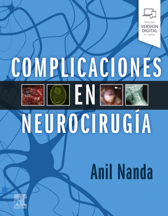 Complicaciones en neurocirugía (e-bog) af Nanda, Anil