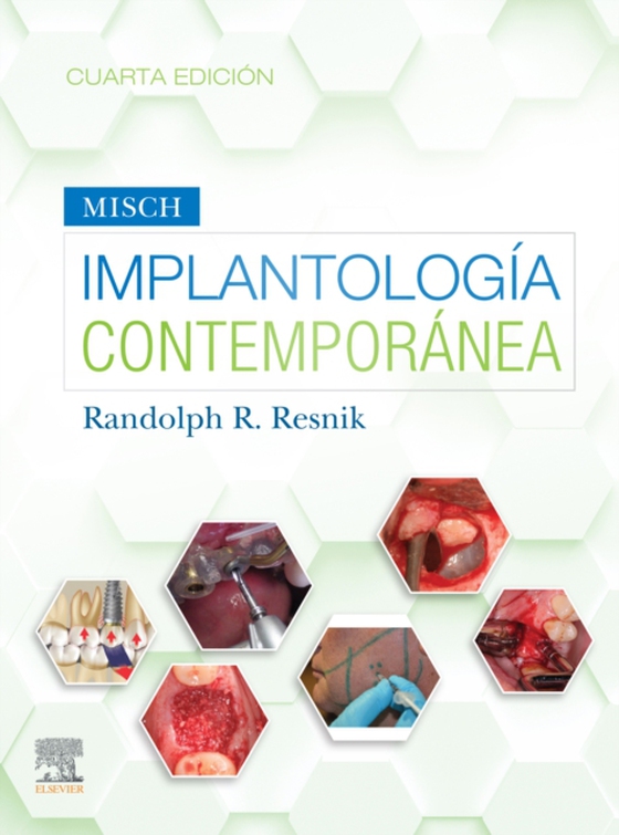 Misch. Implantología contemporánea (e-bog) af -