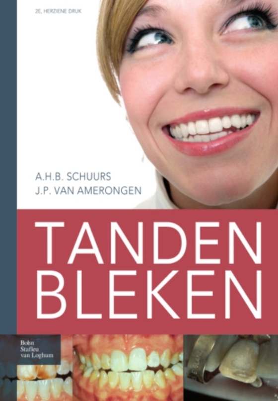 Tanden bleken