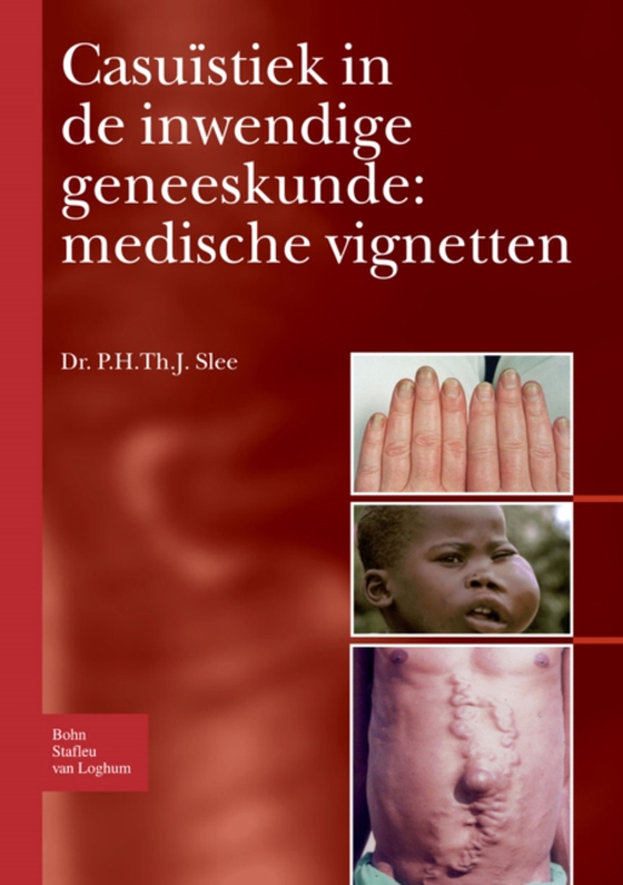 Casuïstiek in de inwendige geneeskunde: medische vignetten (e-bog) af Slee, P. H. Th. J.