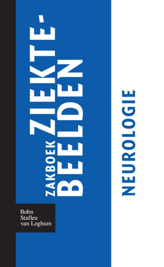 Zakboek ziektebeelden Neurologie (e-bog) af Linden, Karin