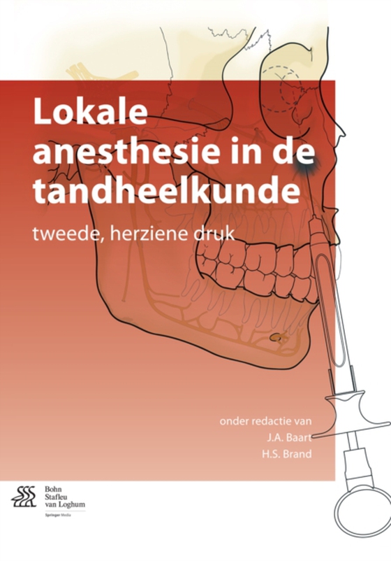 Lokale anesthesie in de tandheelkunde (e-bog) af -