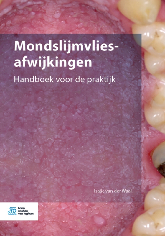 Mondslijmvliesafwijkingen