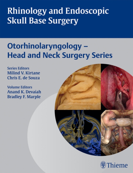 Rhinology and Endoscopic Skull Base Surgery (e-bog) af -