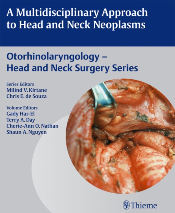 Multidisciplinary Approach to Head and Neck Neoplasms (e-bog) af -