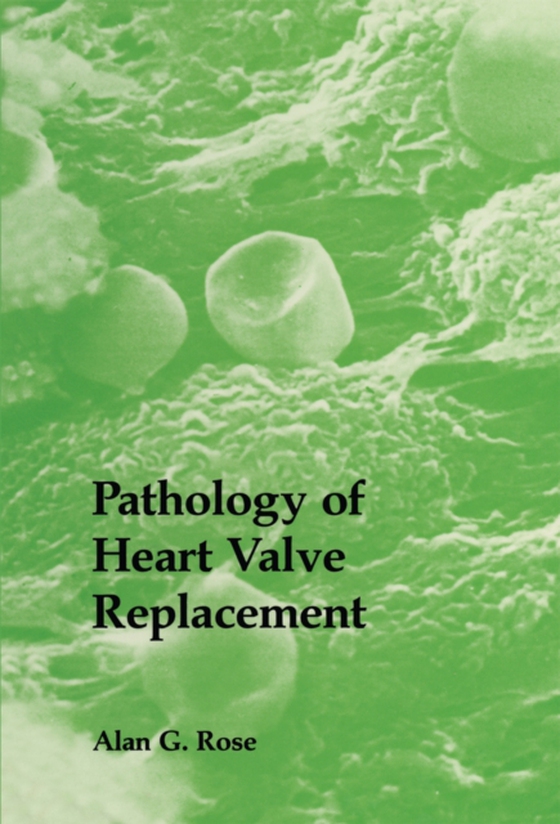 Pathology of Heart Valve Replacement (e-bog) af Rose, A.G.