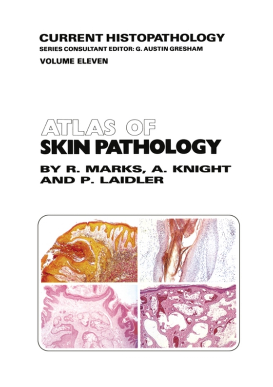 Atlas of Skin Pathology (e-bog) af Laidler, P.