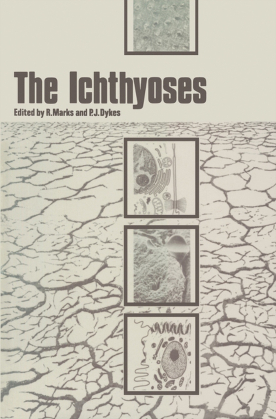 Ichthyoses (e-bog) af -