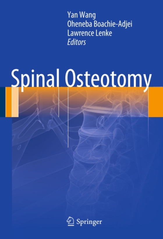 Spinal Osteotomy (e-bog) af -