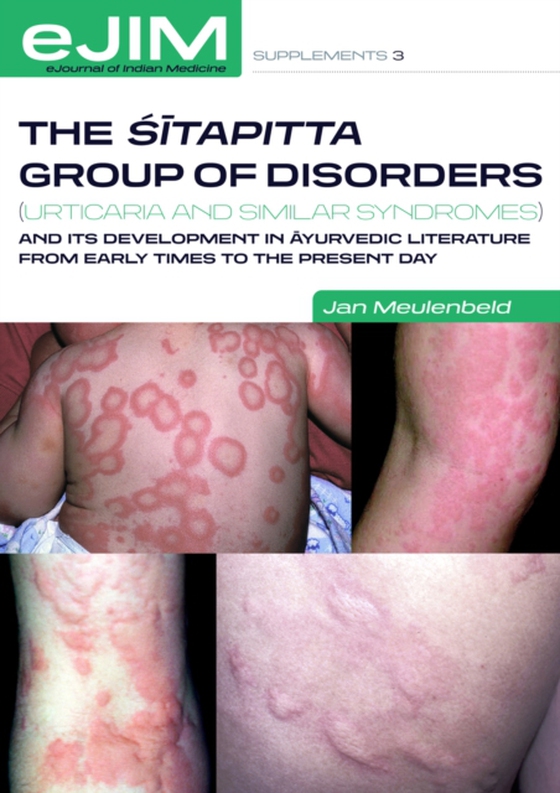 Sitapitta group of disorders (urticaria and similar syndromes) and its development in ayurvedic literature from early times to the present day (e-bog) af Jan Meulenbeld, Meulenbeld