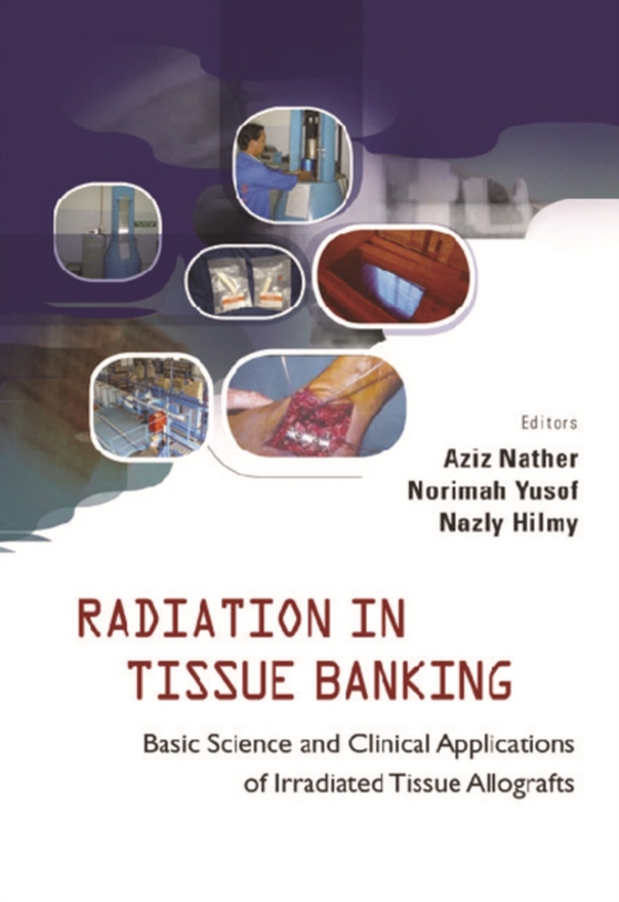 Radiation In Tissue Banking: Basic Science And Clinical Applications Of Irradiated Tissue Allografts