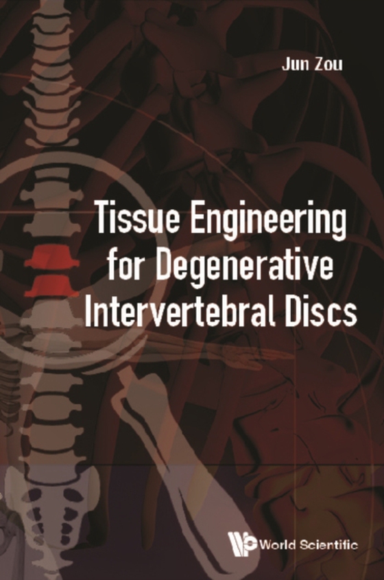 Tissue Engineering For Degenerative Intervertebral Discs (e-bog) af Jun Zou, Zou