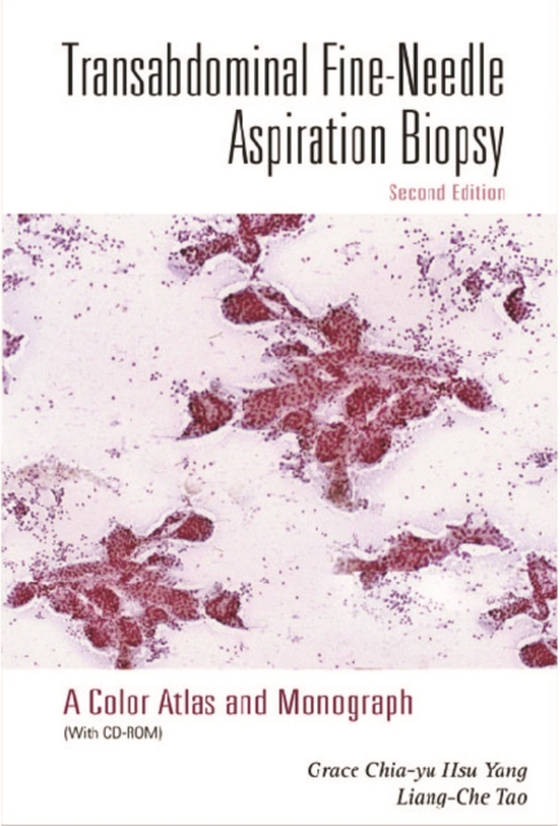 Transabdominal Fine-needle Aspiration Biopsy (2nd Edition): A Color Atlas And Monograph (With Cd-rom)