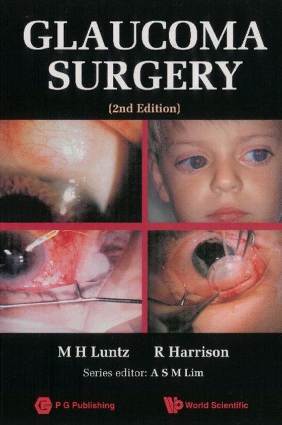 Glaucoma Surgery (2nd Edition) (e-bog) af Raymond Harrison, Harrison