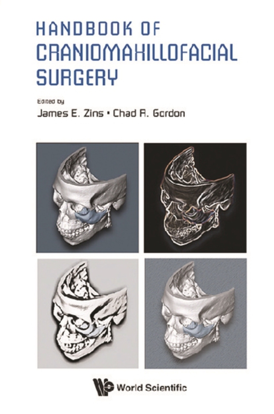 Handbook Of Craniomaxillofacial Surgery