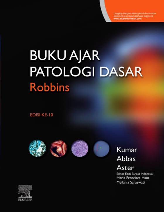 Buku Ajar Patologi Robbins - E-book (e-bog) af Aster, Jon C.