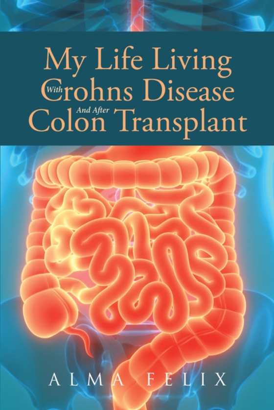 My Life Living With Crohns Disease And After Colon Transplant Surgery (e-bog) af Felix, Alma