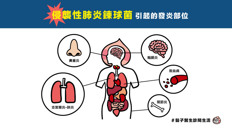 流感的併發症才最恐怖,你不能不知道的侵襲性肺炎鏈球菌! 流感的併發症才最恐怖,你不能不知道的侵襲性肺炎鏈球菌!