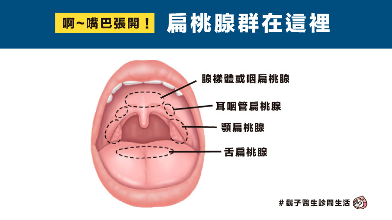 扁桃腺割了會怎樣 免疫功能會不會變差 親子天下