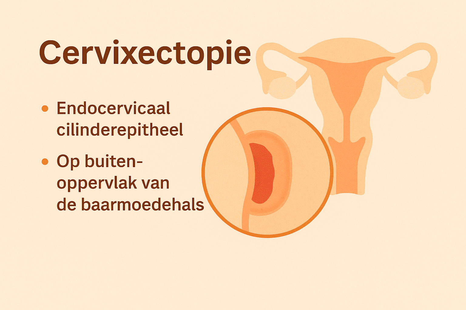 Cervixectopie: Alles dat je moet weten