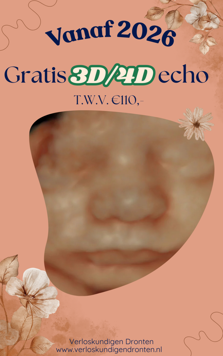 Gratis 3D en 4D echo verloskundigen Dronten
