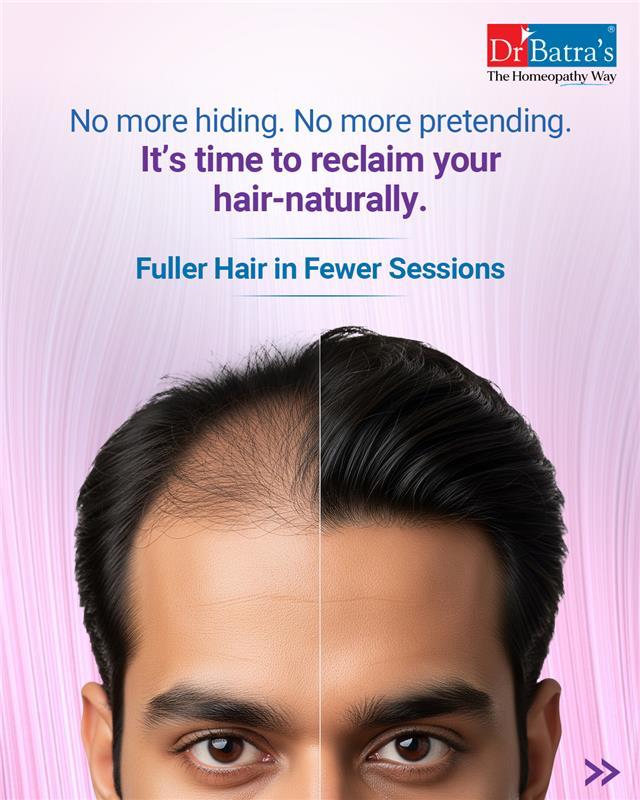 Still stuck in the endless hair fall cycle? 💇‍♀️💔

It’s time to choose a solution that truly understands your hair.
✨ XOGEN Advance by Dr Batra’s® - backed by science, powered by nature, and customised just for you.

No more guessing. Just real, visible results you can trust. 🌿

Book your consultation: 
📞 +91 91671 91671
🌐 www.drbatras.com


.
.
#DrBatras #DrBatrasHealthcare #HairRegrowth #SafeHairCare #DrBatrasXOGENAdvance #XOGENAdvance #FullerHairFewerSessions #10XConfidence #10BillionExosomes #10XMoreExosomes #NaturalTreatment #HairTransplantRisks #AbJeetoJaddSe #TheHomeopathyWay #HomeopathyCare #NaturalCare #HealingFromWithin #HairCareThatWorks #ConfidenceRestored