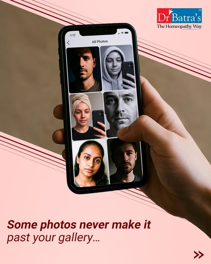 Some photos never make it past the gallery — not because they weren’t beautiful, but because you didn’t feel like yourself. 💔

This #WorldPhotographyDay, let’s change that.
Step back into the frame with confidence, joy, and care that heals from the root. 🌿💙

✨ With Dr Batra’s® XOGEN Advance — powered by 10 Billion Exosomes, visible results in just 4 sessions.
Because when you feel good inside, every picture becomes a celebration.

📞 Call: +91 91671 91671
🌐 Visit: www.drbatras.com


.
.
#DrBatras #DrBatrasHealthcare #HairRegrowth #Topical #Wishing #Celebrating #Photography #WorldPhotographyDay #SafeHairCare #DrBatrasXOGENAdvance #XOGENAdvance #FullerHairFewerSessions #10XConfidence #10BillionExosomes #10XMoreExosomes #NaturalTreatment #HairTransplantRisks #AbJeetoJaddSe #TheHomeopathyWay #HomeopathyCare #NaturalCare #HealingFromWithin #HairCareThatWorks #ConfidenceRestored