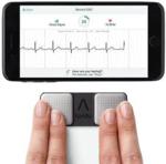 Alivecor Kardia Monitor Ekg