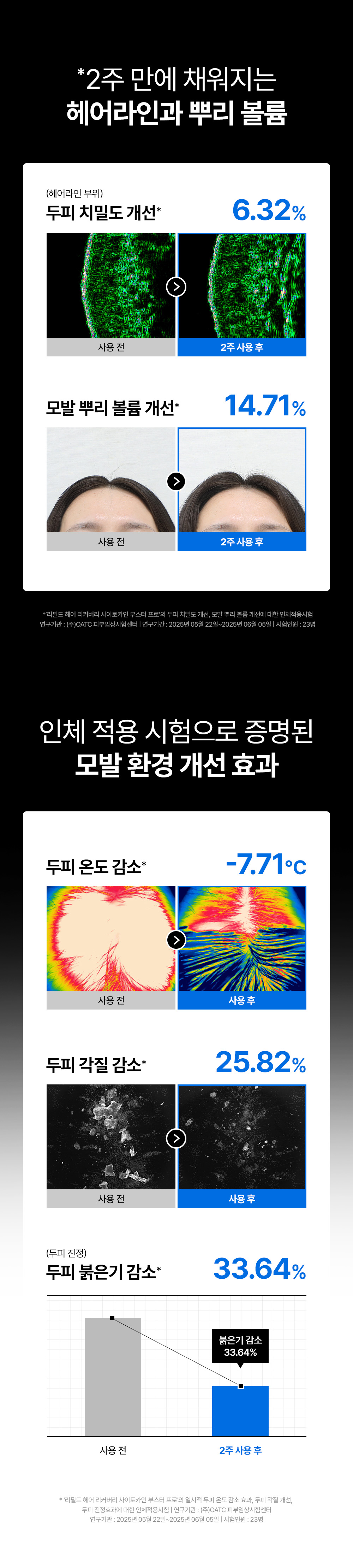 리필드 사이토카인 cADPR 헤어토닉 부스터 프로 70ml 2개 두피앰플