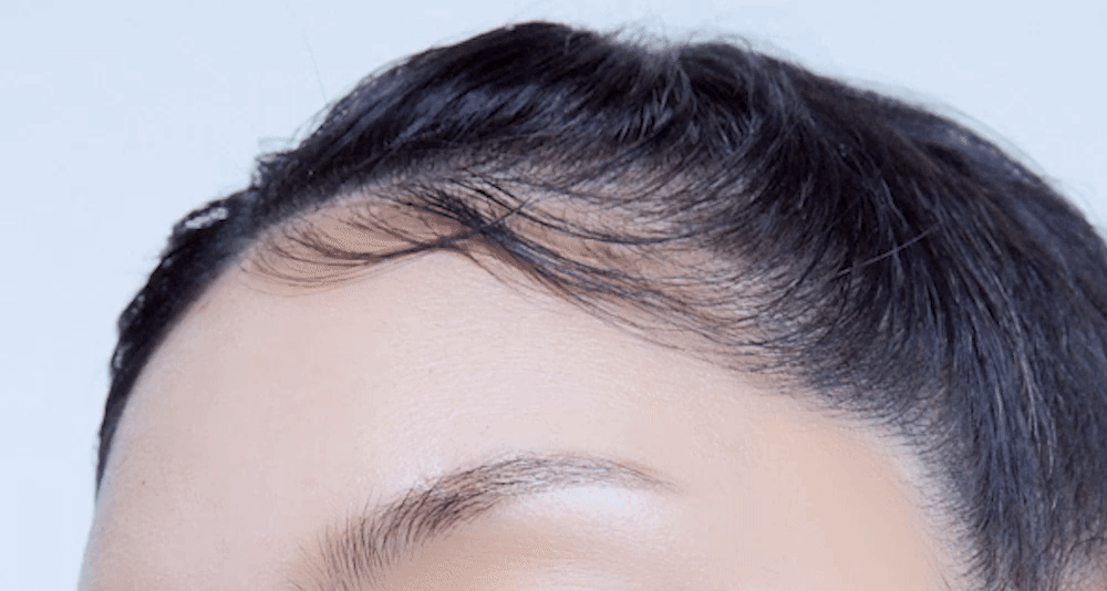 11.gif의 사본.gif