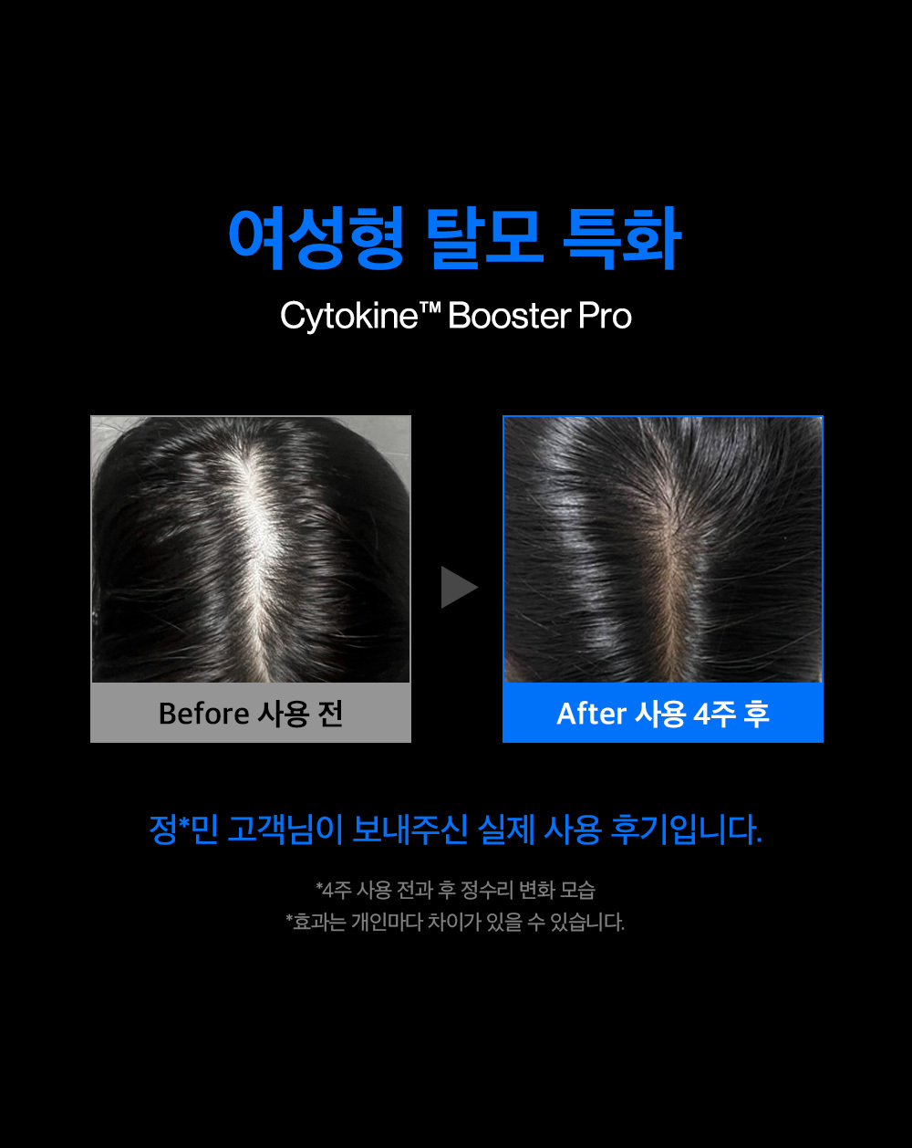 B&A 교체페이지.jpg