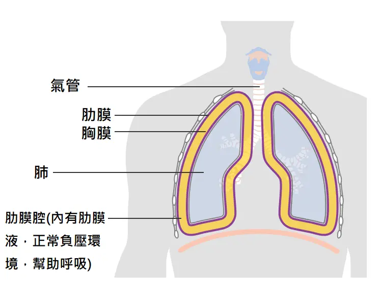 氣胸