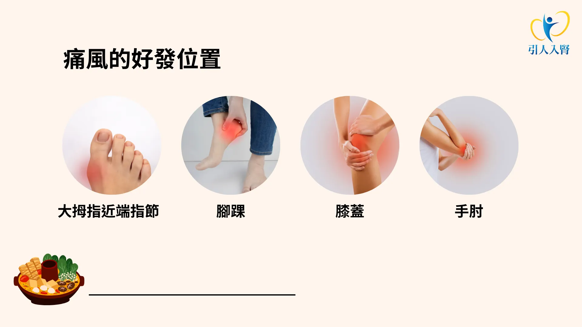 痛風的症狀