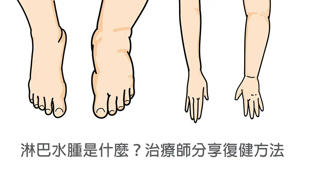 水腫