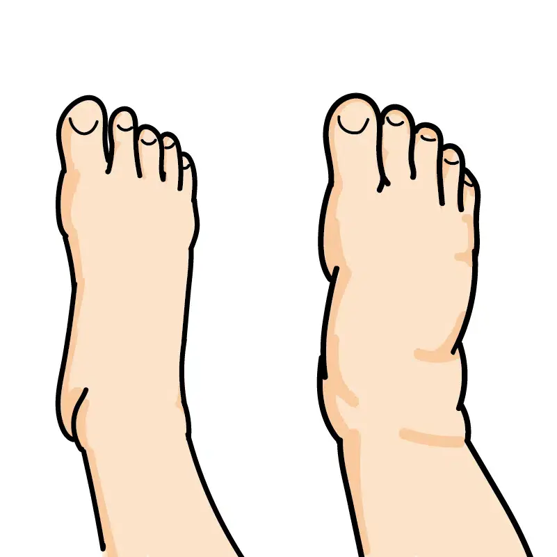 大象腿