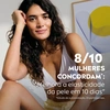 Produto 1585332