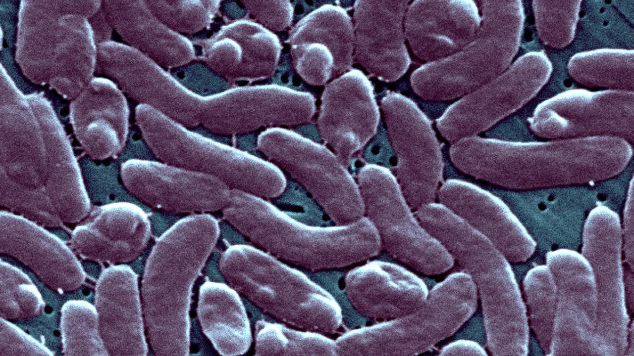 Bacteria Vibrio vulnificus acaba con la vida de tres personas