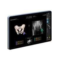 Smith+Nephew CORI Surgical — Мобильная платформа — фото 2