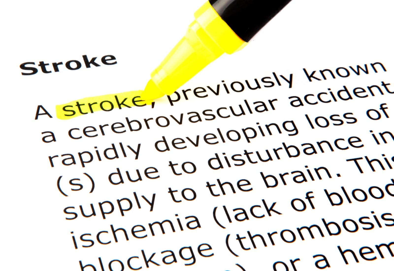 Minimalkan Risiko Stroke dengan MRA