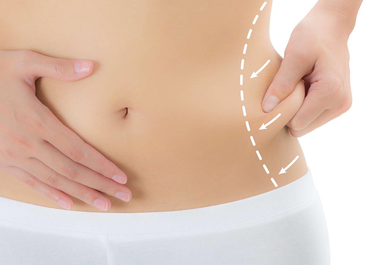 Ramping dan Sehat dengan Liposuction