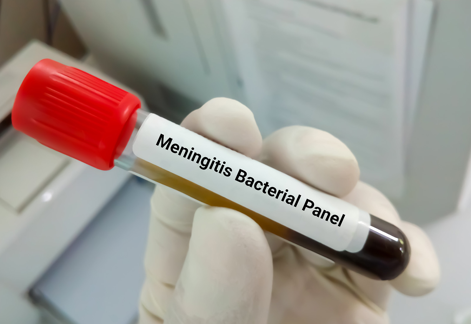 Pahami Cara Penularan Meningitis dan Cara Mencegahnya