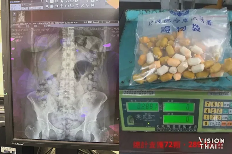 【RtiTalk 法律警世鐘】拿命換錢！吞下72顆毒品膠囊闖關——在台灣走私毒品下場有多慘？ 🚫⚖️ 1