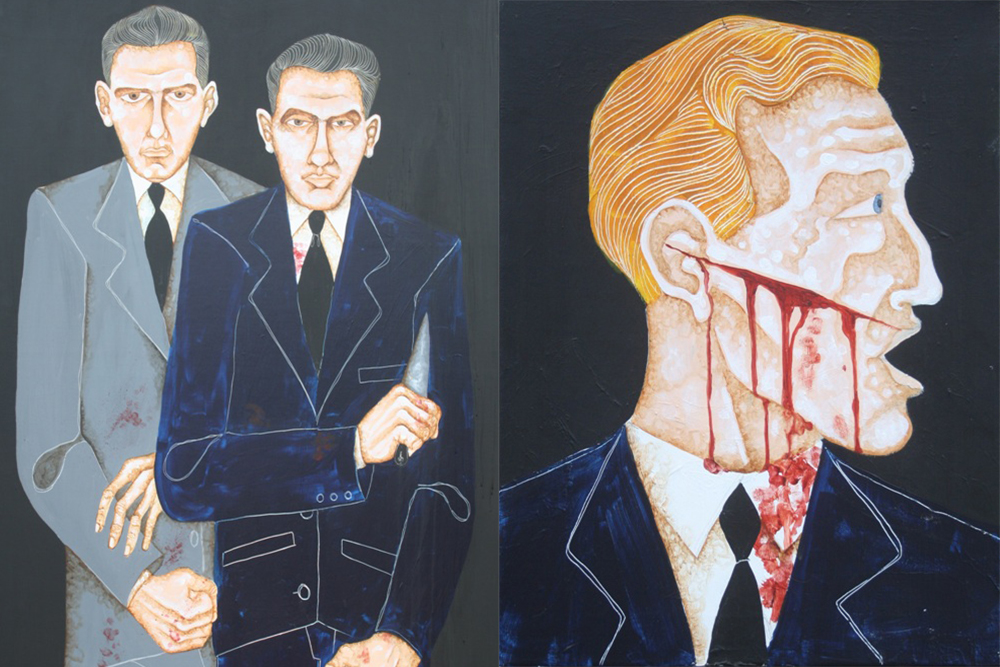 Left: The Krays – Right: Member of a Rival Firm with a Razor Slash